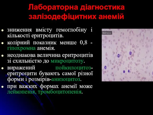 Лабораторна діагностика залізодефіцитних анемій зниження вмісту гемоглобіну і кількості еритроцитів.