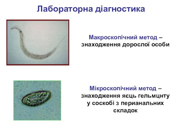 Лабораторна діагностика Макроскопічний метод – знаходження дорослої особи Мікроскопічний метод