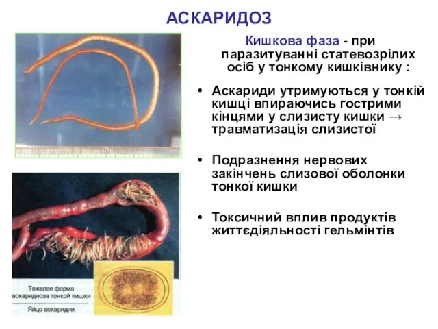 АСКАРИДОЗ Кишкова фаза - при паразитуванні статевозрілих осіб у тонкому