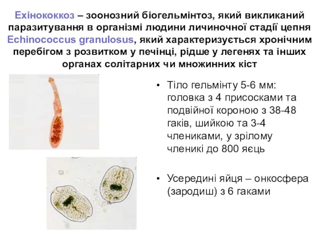 Ехінококкоз – зоонозний біогельмінтоз, який викликаний паразитування в організмі людини