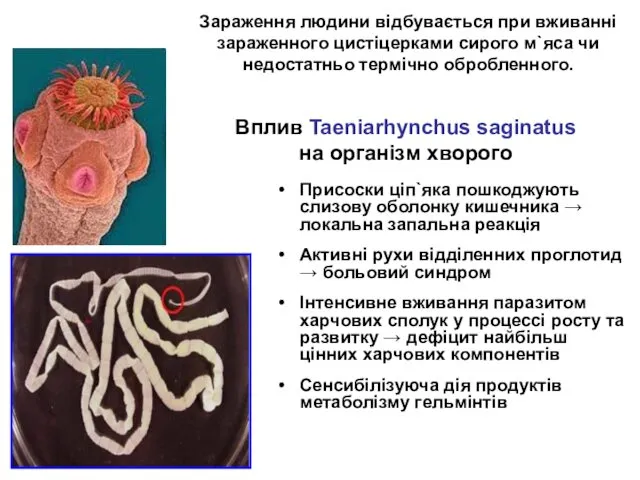 Вплив Taeniarhynchus saginatus на організм хворого Присоски ціп`яка пошкоджують слизову