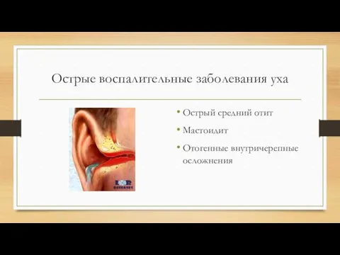 Острые воспалительные заболевания уха Острый средний отит Мастоидит Отогенные внутричерепные осложнения