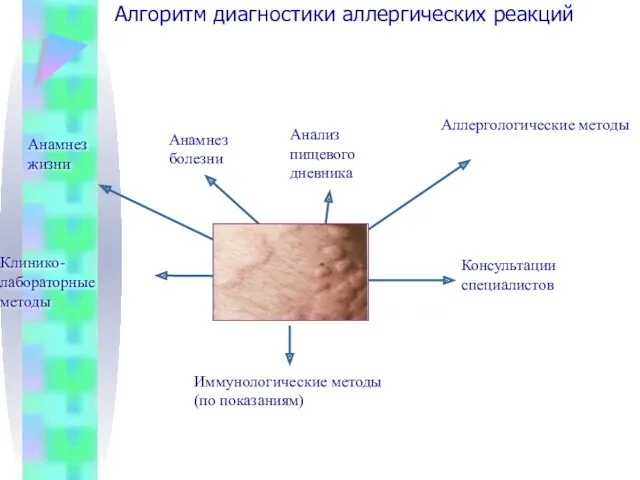 Алгоритм диагностики аллергических реакций Крапивница Анамнез жизни Анамнез болезни Анализ