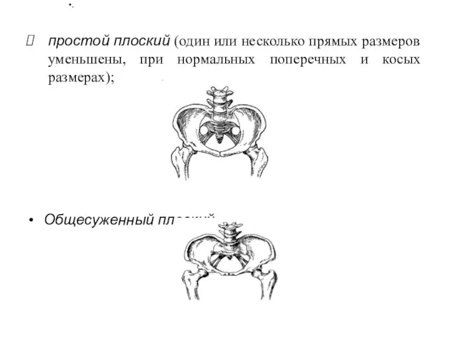 простой плоский (один или несколько прямых размеров уменьшены, при нормальных