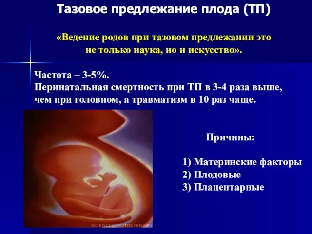 Тазовое предлежание плода (ТП) «Ведение родов при тазовом предлежании это