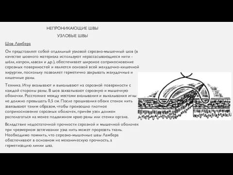 НЕПРОНИКАЮЩИЕ ШВЫ УЗЛОВЫЕ ШВЫ Шов Ламбера Он представляет собой отдельный