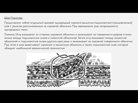 Шов Пирогова Представляет собой отдельный краевой однорядный серозно-мышечно-подслизистый (прецизионный) шов