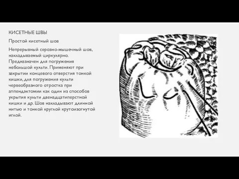 КИСЕТНЫЕ ШВЫ Простой кисетный шов Непрерывный серозно-мышечный шов, накладываемый циркулярно.