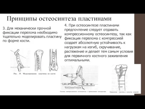 Принципы остеосинтеза пластинами 3. Для механически прочной фиксации перелома необходимо