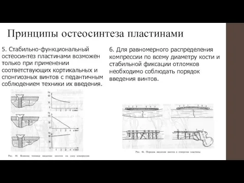 Принципы остеосинтеза пластинами 5. Стабильно-функциональный остеосинтез пластинами возможен только при