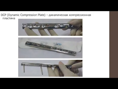 DCP (Dynamic Compression Plate) – динамическая компрессионная пластина