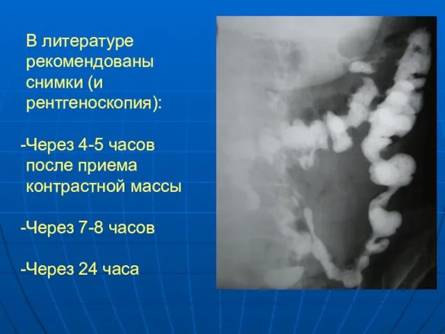 В литературе рекомендованы снимки (и рентгеноскопия): Через 4-5 часов после