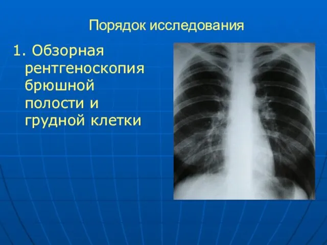 Порядок исследования 1. Обзорная рентгеноскопия брюшной полости и грудной клетки