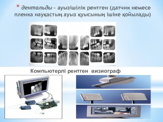 дентальды - ауызішілік рентген (датчик немесе пленка науқастың ауыз қуысының ішіне қойылады) Компьютерлі рентген визиограф