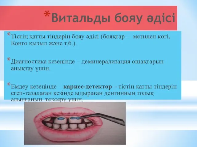 Витальды бояу әдісі Тістің қатты тіндерін бояу әдісі (бояқтар –