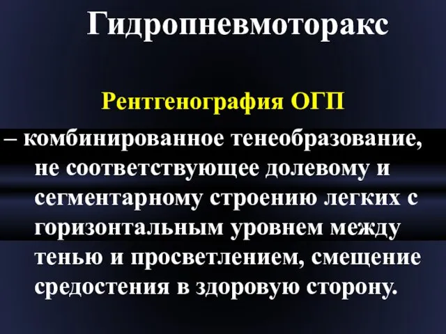 Гидропневмоторакс Рентгенография ОГП – комбинированное тенеобразование, не соответствующее долевому и