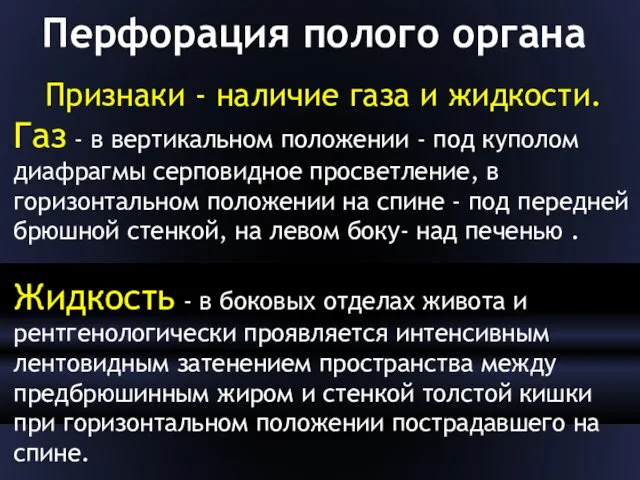 Перфорация полого органа Признаки - наличие газа и жидкости. Газ