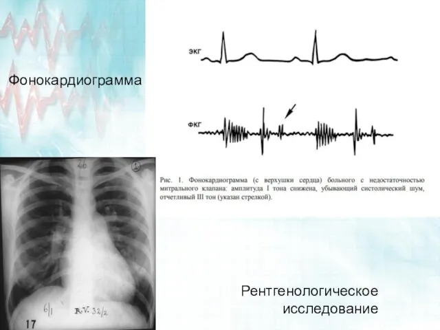 Фонокардиограмма Рентгенологическое исследование