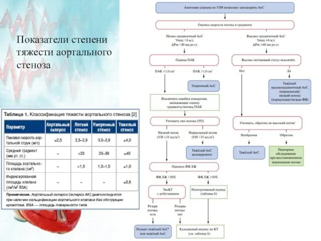 Показатели степени тяжести аортального стеноза