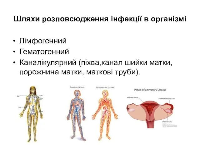 Шляхи розповсюдження інфекції в організмі Лімфогенний Гематогенний Каналікулярний (піхва,канал шийки матки, порожнина матки, маткові труби).