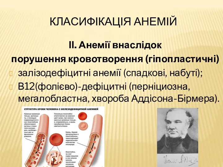 КЛАСИФІКАЦІЯ АНЕМІЙ ІІ. Анемії внаслідок порушення кровотворення (гіпопластичні) залізодефіцитні анемії