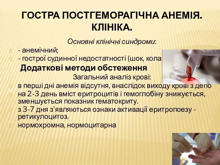 ГОСТРА ПОСТГЕМОРАГІЧНА АНЕМІЯ. КЛІНІКА. Основні клінічні синдроми: - анемічний; -