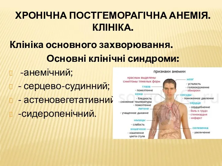 ХРОНІЧНА ПОСТГЕМОРАГІЧНА АНЕМІЯ. КЛІНІКА. Клініка основного захворювання. Основні клінічні синдроми: -анемічний; - серцево-судинний; - астеновегетативний; -сидеропенічний.