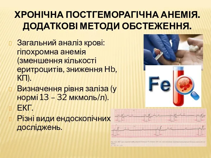 ХРОНІЧНА ПОСТГЕМОРАГІЧНА АНЕМІЯ. ДОДАТКОВІ МЕТОДИ ОБСТЕЖЕННЯ. Загальний аналіз крові: гіпохромна