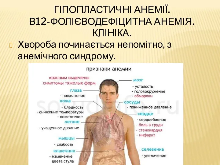 ГІПОПЛАСТИЧНІ АНЕМІЇ. В12-ФОЛІЄВОДЕФІЦИТНА АНЕМІЯ. КЛІНІКА. Хвороба починається непомітно, з анемічного синдрому.