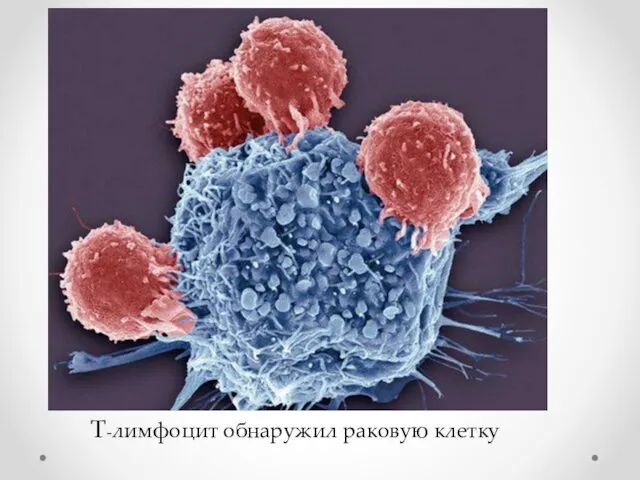 Т-лимфоцит обнаружил раковую клетку