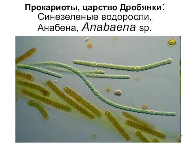 Прокариоты, царство Дробянки: Синезеленые водоросли, Анабена, Anabaena sp.