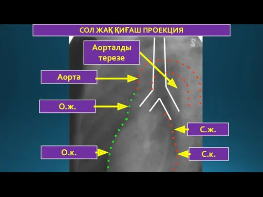 О.к. О.ж. Аорта С.ж. С.к. Аорталды терезе СОЛ ЖАҚ ҚИҒАШ ПРОЕКЦИЯ