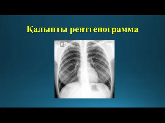 Қалыпты рентгенограмма