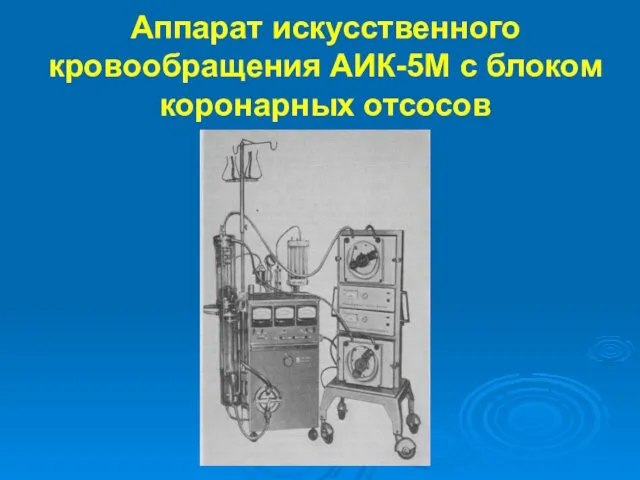 Аппарат искусственного кровообращения АИК-5М с блоком коронарных отсосов