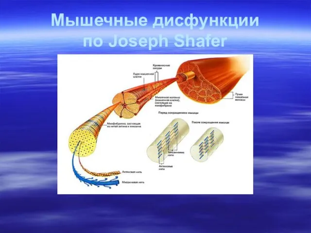 Мышечные дисфункции по Joseph Shafer