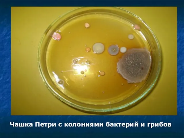 Чашка Петри с колониями бактерий и грибов