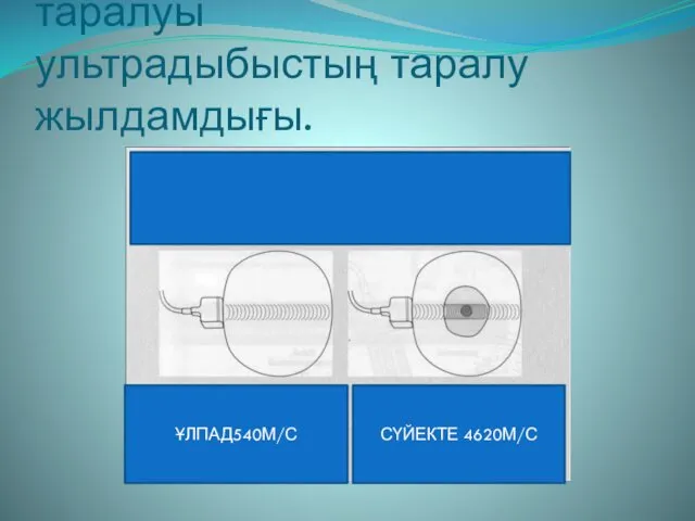 Дыбыс толқындарының таралуы ультрадыбыстың таралу жылдамдығы. ҰЛПАД540М/С СҮЙЕКТЕ 4620М/С