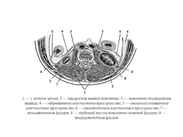 1 — т. errector spinae; 2 — квадратная мышца поясницы;