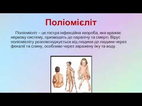 Поліомієліт Поліомієліт – це гостра інфекційна хвороба, яка вражає нервову