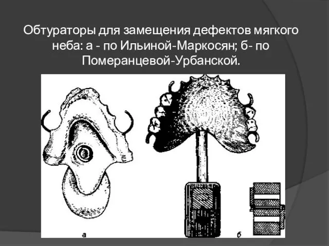 Обтураторы для замещения дефектов мягкого неба: а - по Ильиной-Маркосян; б- по Померанцевой-Урбанской.