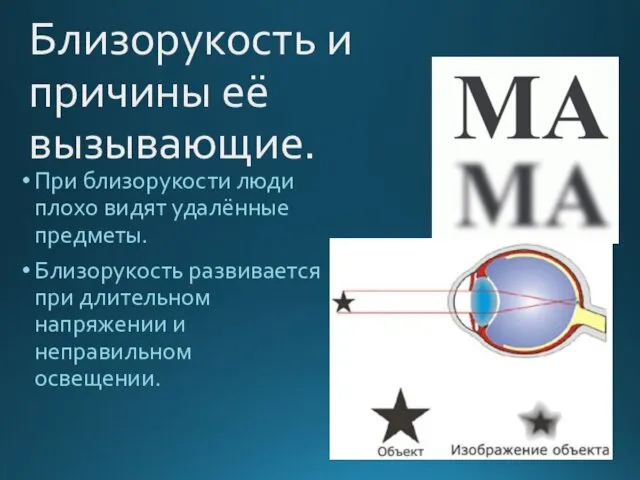 Близорукость и причины её вызывающие. При близорукости люди плохо видят