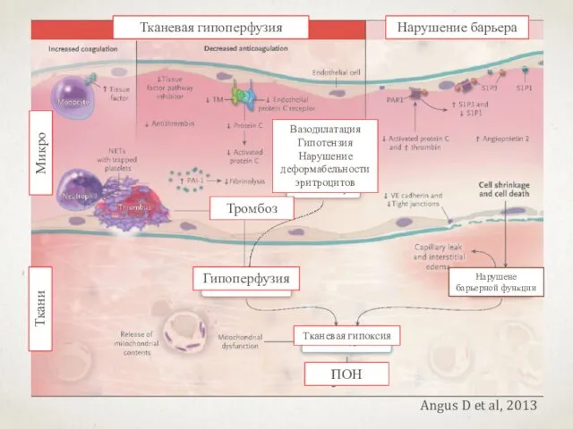 Angus D et al, 2013 Тканевая гипоперфузия ПОН Ткани Микро