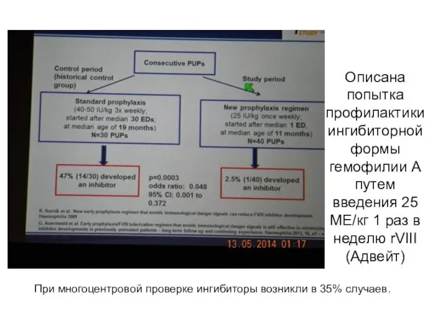 Описана попытка профилактики ингибиторной формы гемофилии А путем введения 25