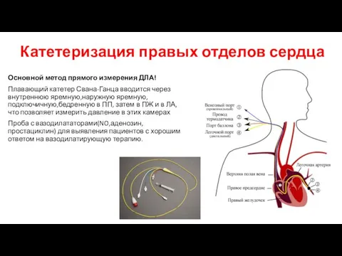 Катетеризация правых отделов сердца Основной метод прямого измерения ДЛА! Плавающий