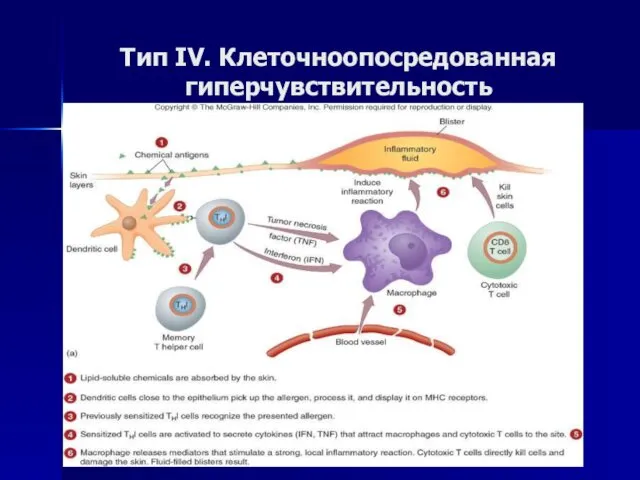 Тип IV. Клеточноопосредованная гиперчувствительность