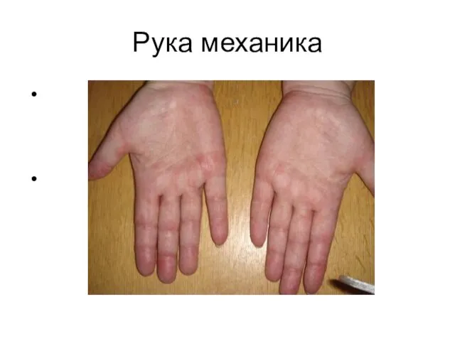 Рука механика