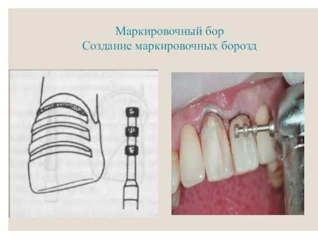 Маркировочный бор Создание маркировочных борозд