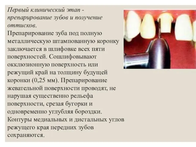Первый клинический этап - препарирование зубов и получение оттисков. Препарирование зуба под полную