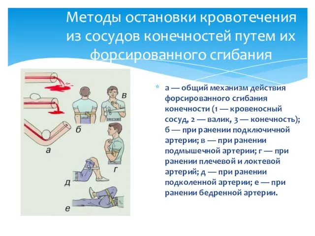 а — общий механизм действия форсированного сгибания конечности (1 —