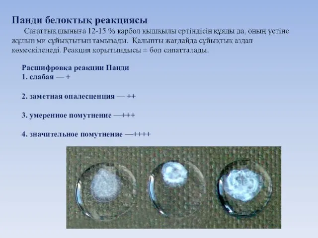 Расшифровка реакции Панди 1. слабая — + 2. заметная опалесценция — ++ 3.